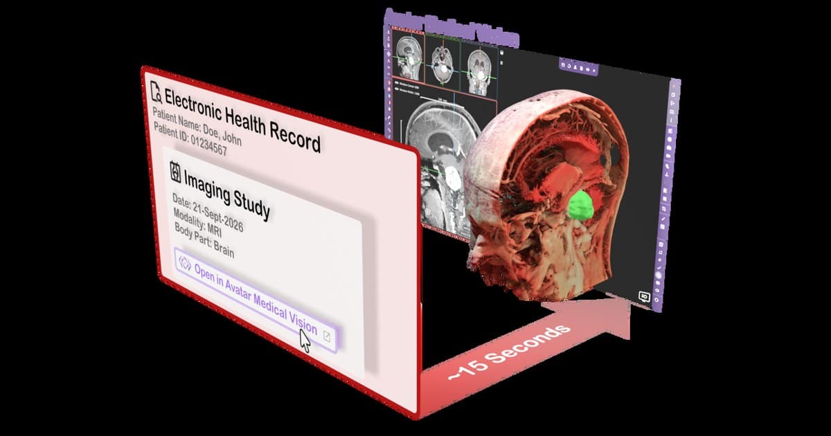 Avatar Medical Integrates with Epic to Speed Access to Patient-Specific 3D Anatomy in Clinics