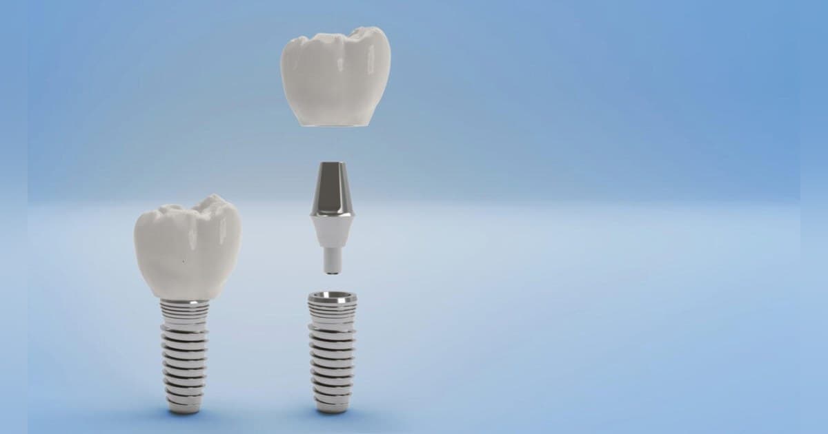 Gunbarrel Dental Center Expands Patient Education on Professional Teeth Whitening
